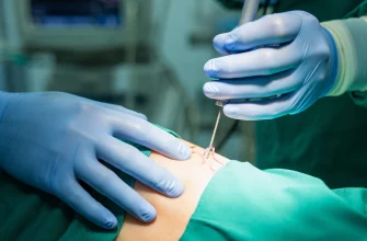 Эндовазальная лазерная коагуляция вен принципы и применение
